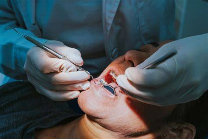 A dentist warned against the trend of emptying toothpaste into a clear container
