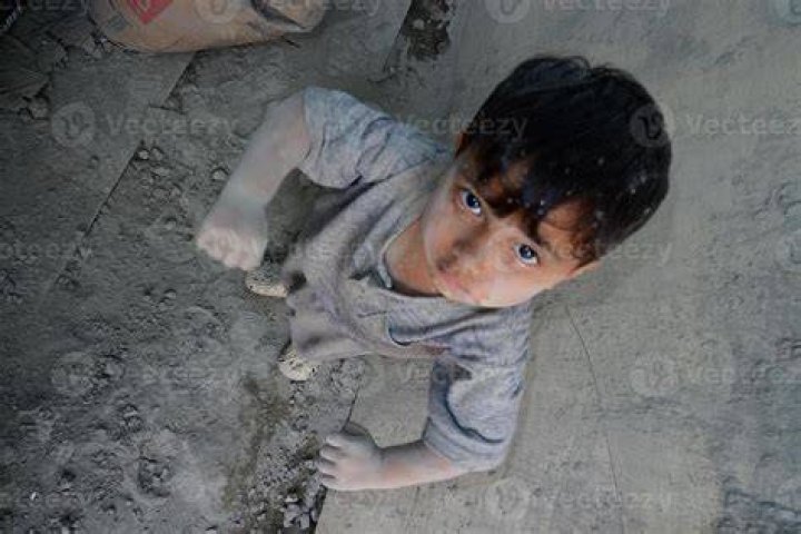 A little boy is covered in blood after his head was cut with a razor