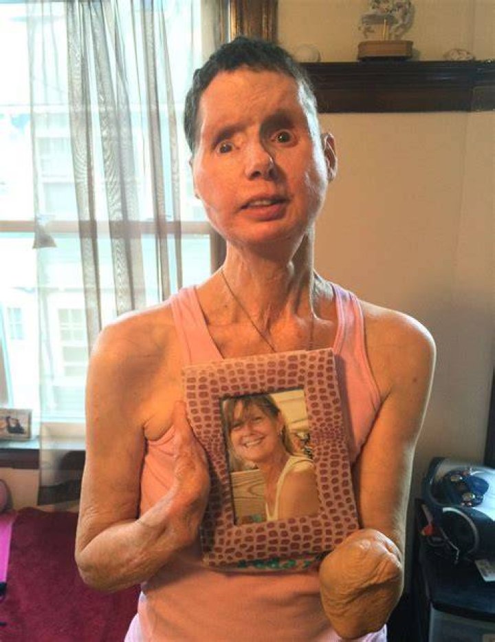  A photo of Charla Nash taken before the haunting 2009 attack