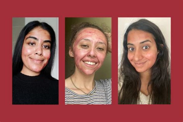 After peeling back the mask, your lips will be a bold red hue
