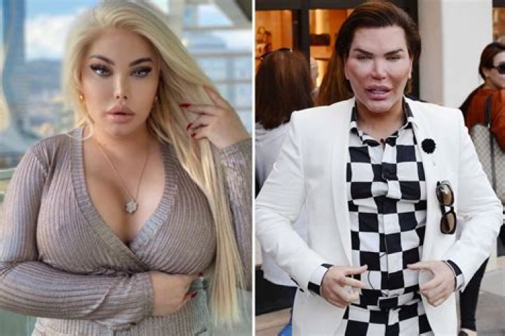 Alves said her weight gain had impacted on her confidence