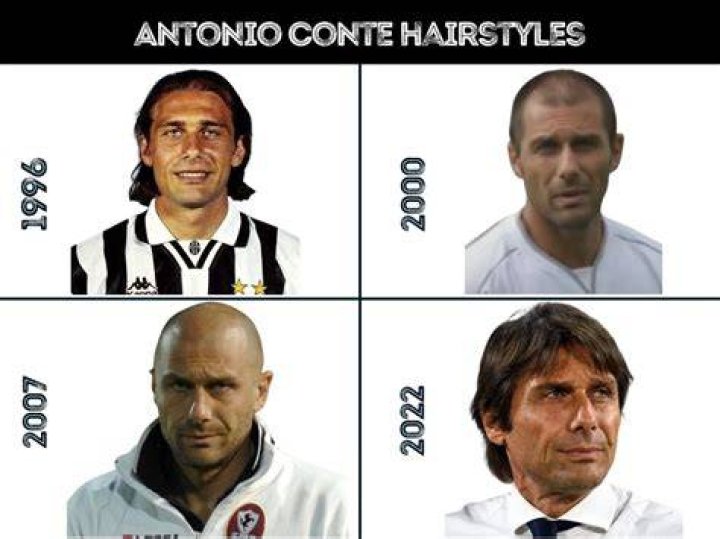  Antonio Conte going thin up top during his playing days at Juventus