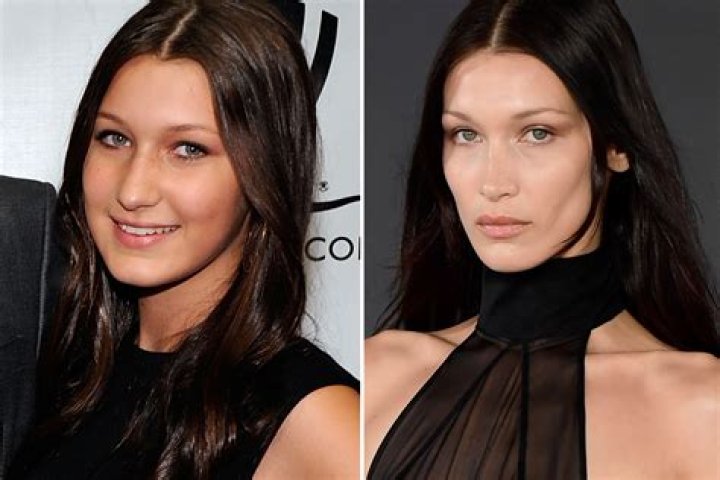 Bella had a nose job when she was 14
