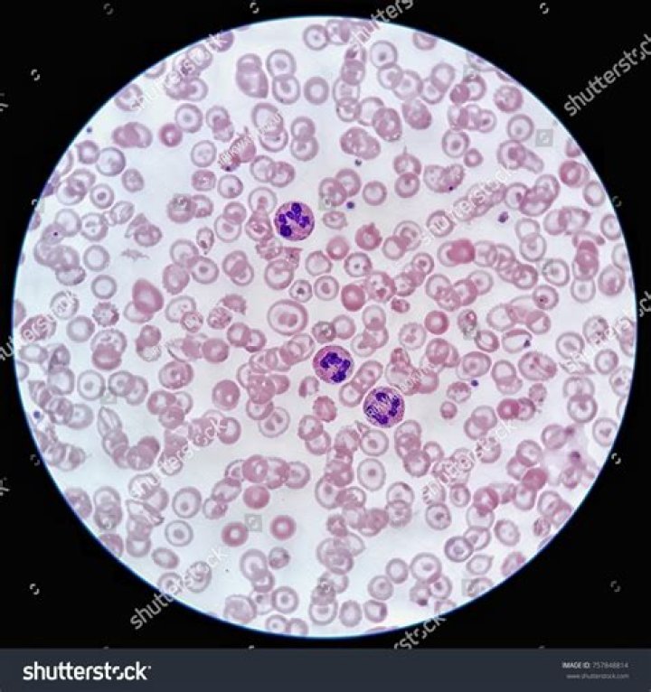 Blood can be seen on the hospital floor after Peyton developed a severe coughing fit