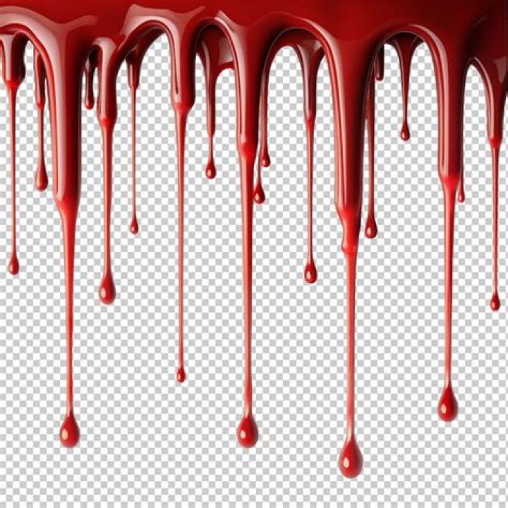 Blood drips from a man's head during the holy festival in Iraq