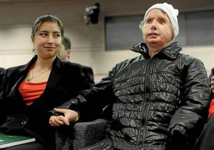  Charla Nash first spoke about the attack with TV host Oprah, just months after it took place