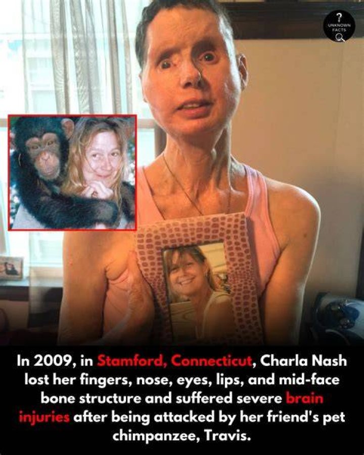  Charla Nash suffered horrific, life changing injuries from the attack