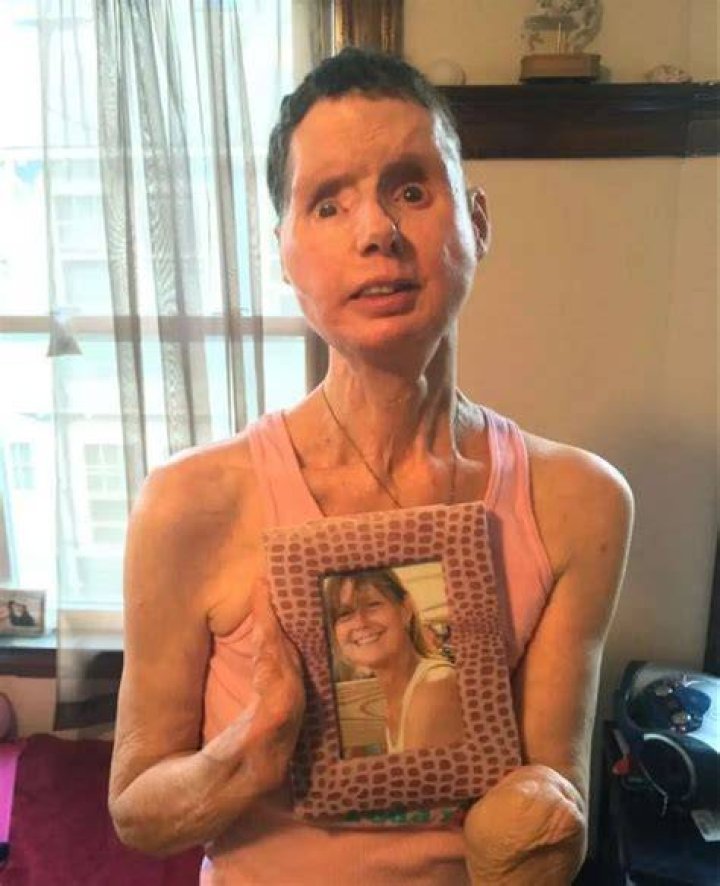 Charla was left with severe facial injuries - but has undergone numerous surgeries