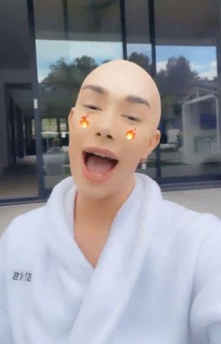 Charles also debuted his bald head earlier this week and claims it is 'real'
