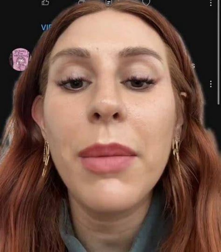 Charlotte Dobre gets told her 'lip filler is atrocious'
