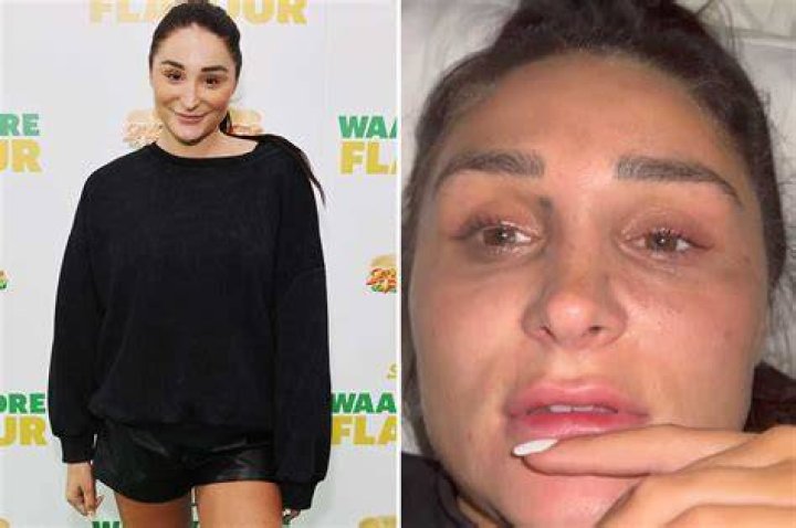 Chloe looked completely different when she returned to the limelight. Pictured here in 2016