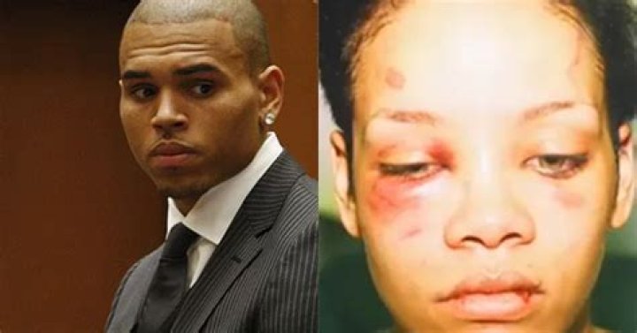 Chris punched and bit Rihanna in the heat of their argument