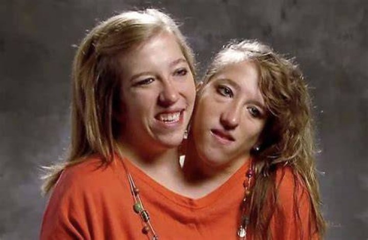 Conjoined Twins Abby and Brittany Hensel Clap Back to Haters After Comments Over Wedding News
