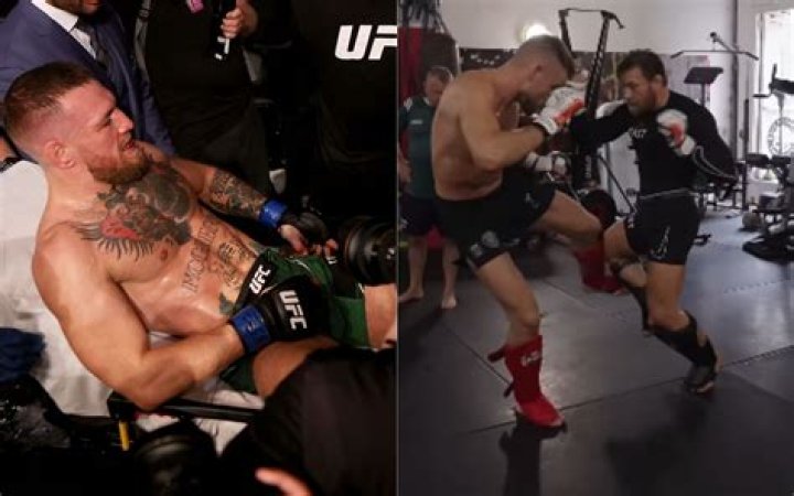Conor McGregor looks at his broken leg during following his UFC 264 trilogy with Dustin Poirier
