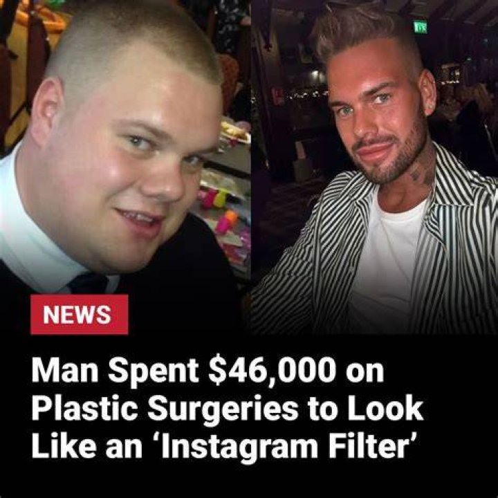 Dale Cullen spent &pound;25,000 on procedures to look perfect on social media