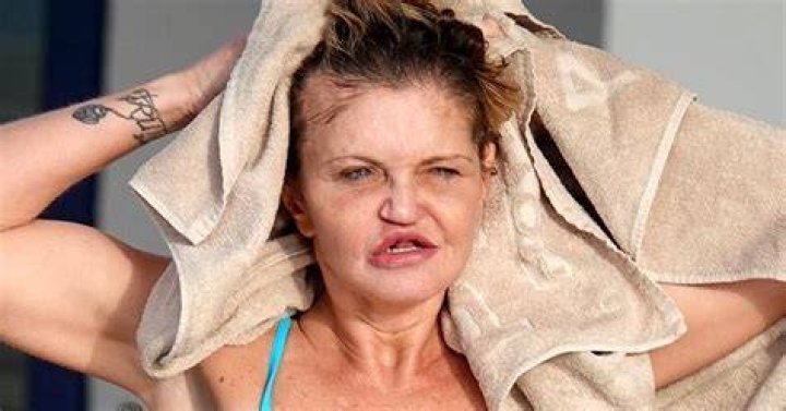 Danniella Westbrook hit out after getting cruel comments on her page