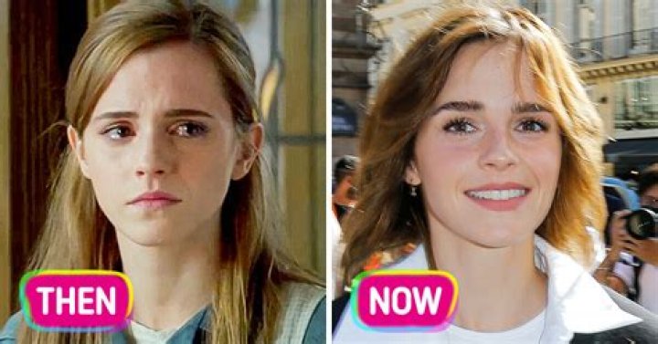 Emma Cousins had her left eye removed when she was diagnosed with rare cancer