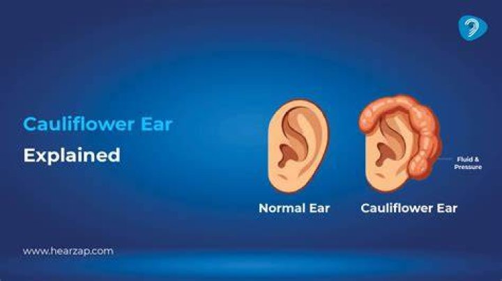  Got a cauliflower ear to go with that? Lizet and her employees weren't supposed to be vegging out