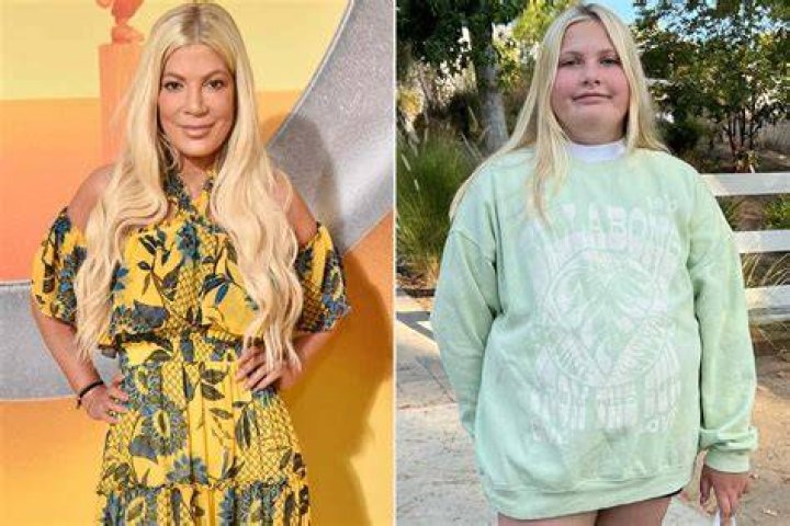 Hattie now shares pictures of her bald patch