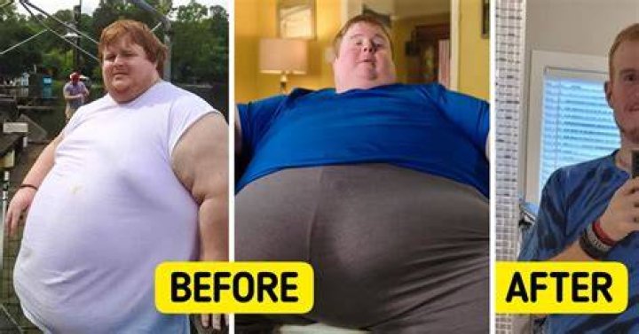  He documented his journey after withdrawing from steroids, here his skin is red, bleeding and cracked
