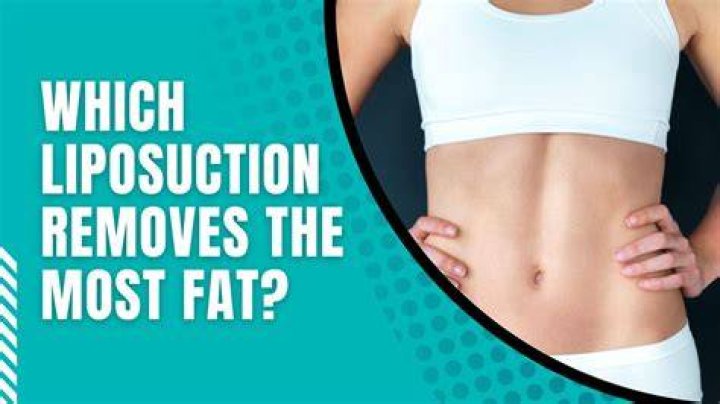 He removes fat and puts it into the bum