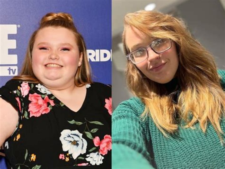  Honey Boo Boo star Anna had her veneers put in at Dr Wahab's in Beverly Hills