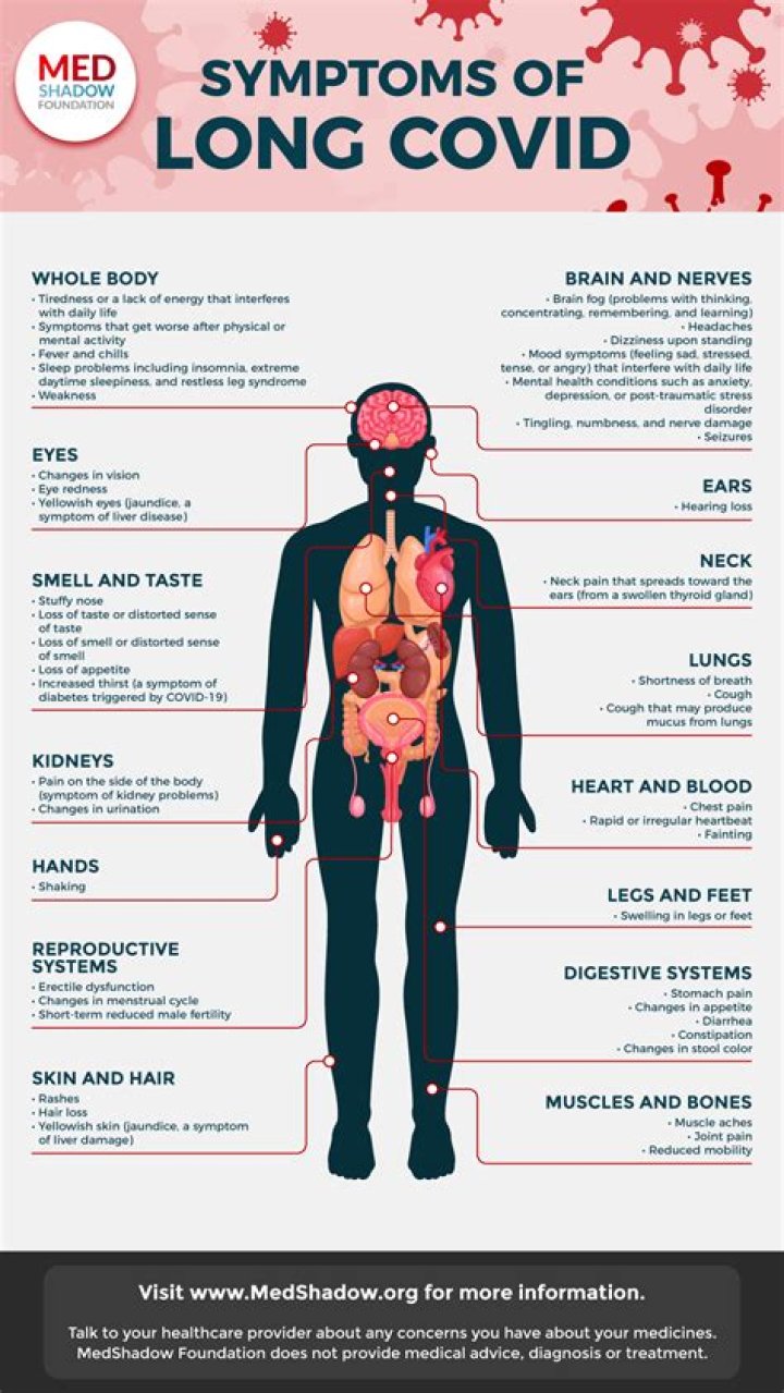 How Covid symptoms are changing thanks to heard immunity from prior infections and vaccines