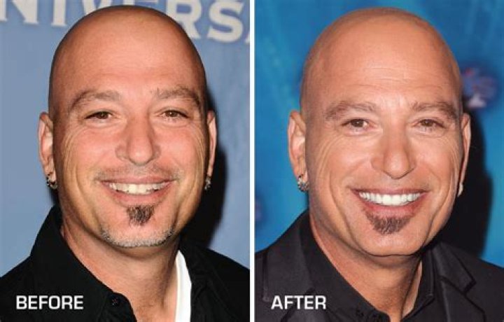 Howie Mandel looked unrecognizable after a shocking change in appearance during the America's Got Talent live show