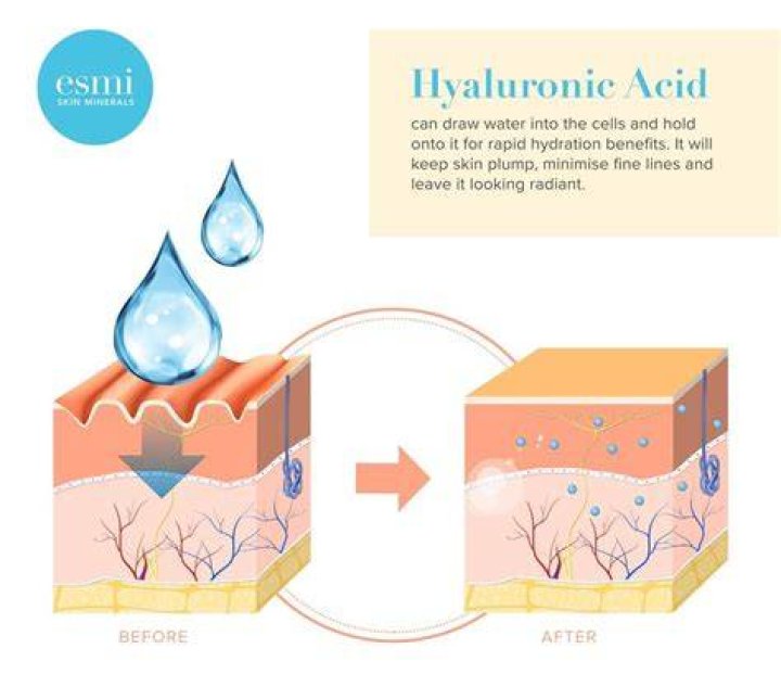 hyaluronic acid