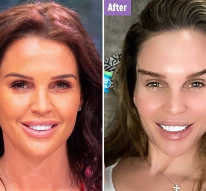 In 2021, Danielle Lloyd reveals she’s had secret eye lift surgery behind husband’s back and he was furious when he found out