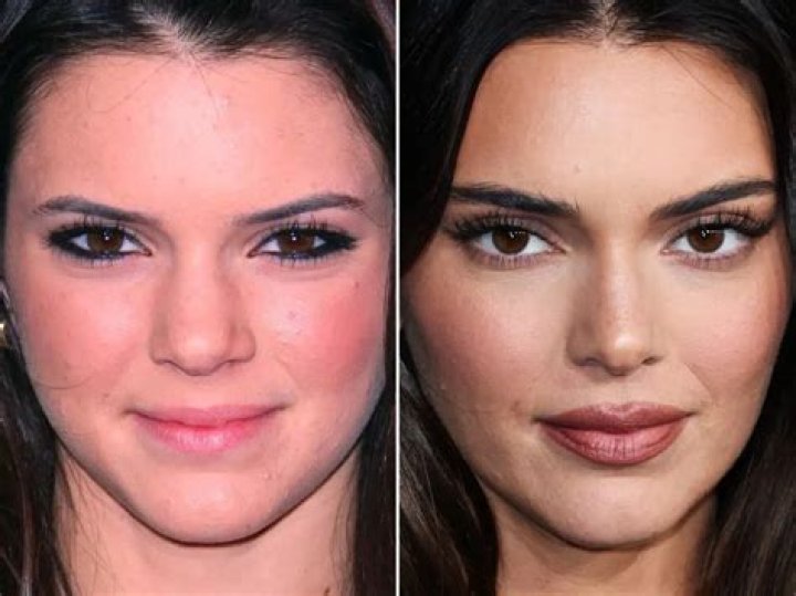 It came months after Kendall split from her NBA star ex-Devin Booker