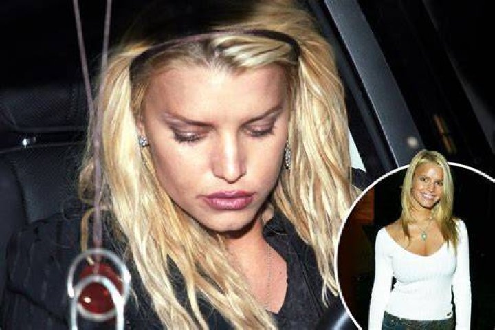  Jessica took diet pills for decades and then getting a partial tummy tuck to celebrate her 35th birthday