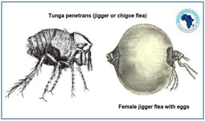 Jiggers or chigoe fleas are pretty tiny and hard to spot when they are biting you
