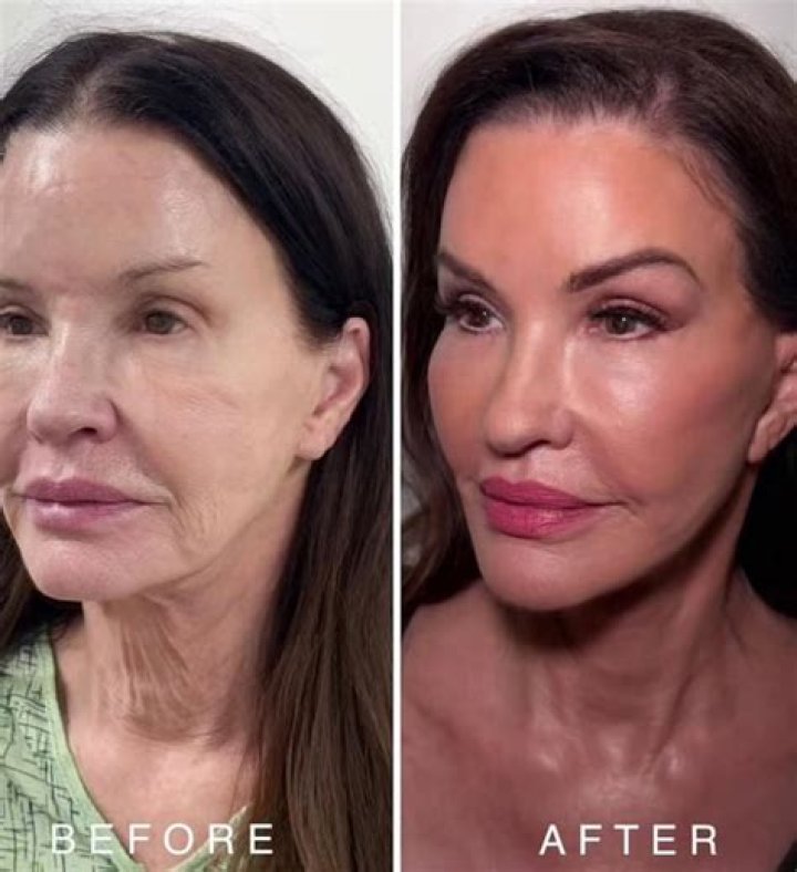 Jo underwent several procedures last year to remove part of a slipped disc and feared they would stop her ever dancing again