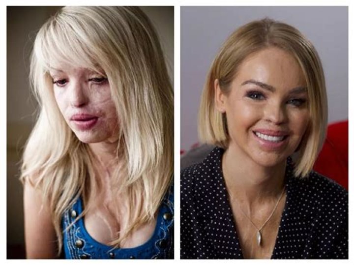  Katie Piper pictured before she was attacked