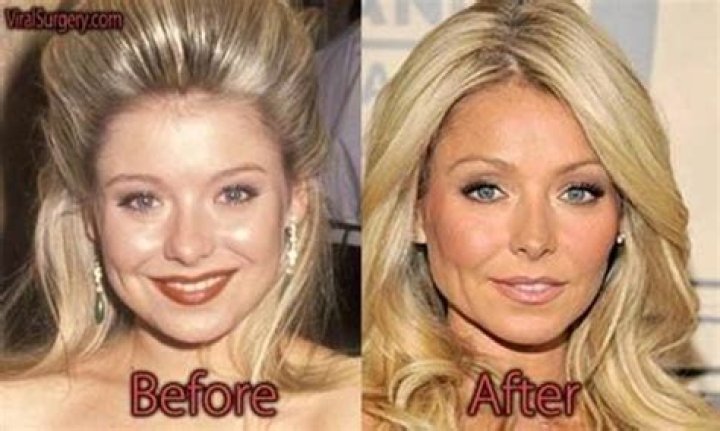 kelly-ripa-nose-job-comments