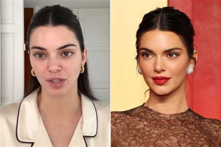 Kendall is no stranger to showing off some skin
