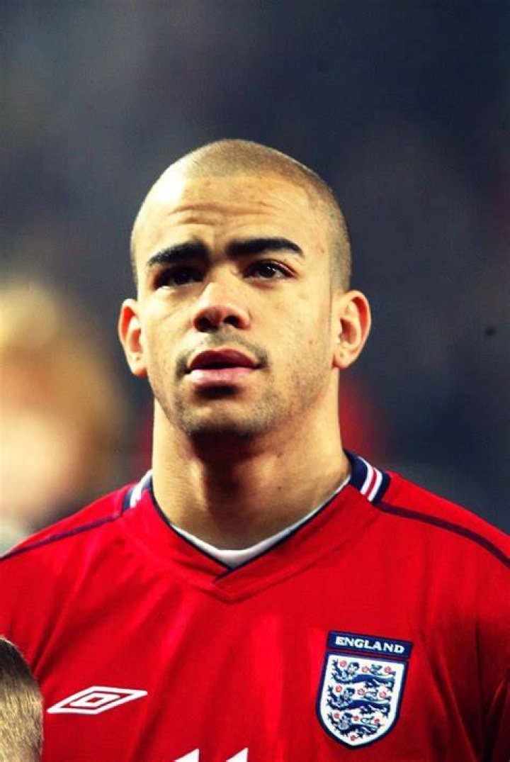  Kieron Dyer's leg buckles in a League Cup clash in 2007