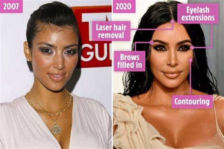 Kim swore off Botox after using it for the first time in 2010, but admitted that she was still using it last year despite fans' please to 'stop doing stuff' to her natural face