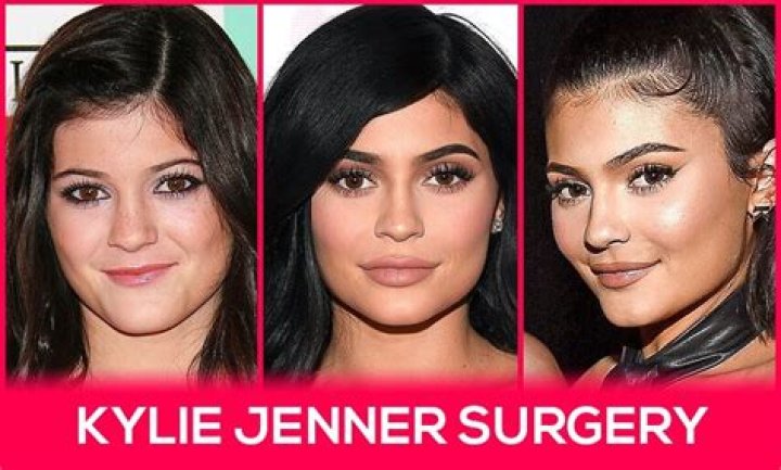  Kylie had surgery to kick start her weight loss