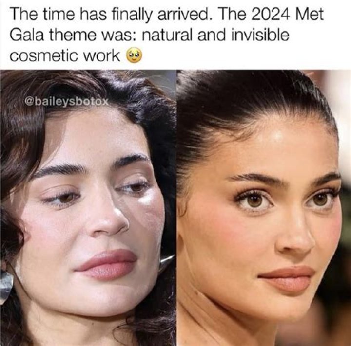 Kylie has faced plenty of plastic surgery rumors over the years (pictured in 2013)