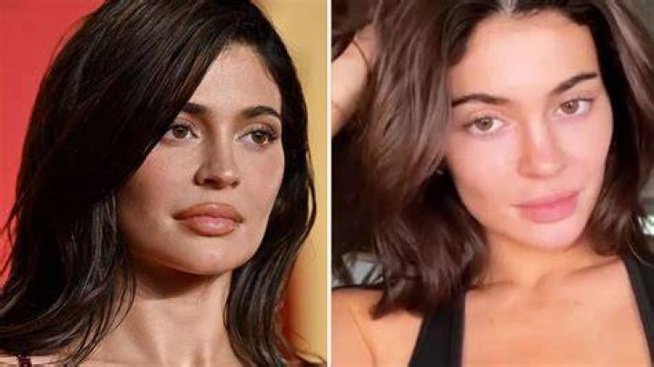 Kylie Jenner fans were shocked at her cheeks in a recently resurfaced selfie