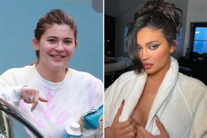 Kylie shared similar photos over the weekend