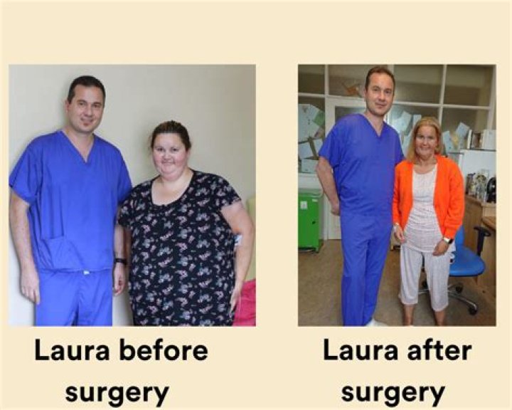 Laura before her surgery with her P sized boobs