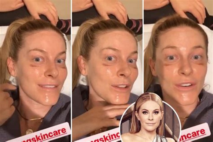 Leah McSweeney showed off her 'new girls' in a post-boob job selfie