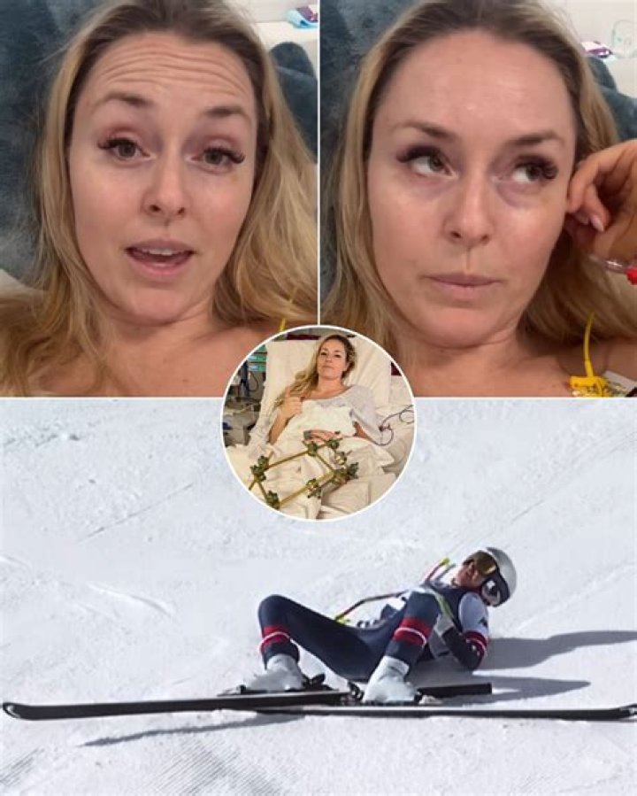 Lindsey Vonn shared behind-the-scenes footage of herself at the dentist getting veneers