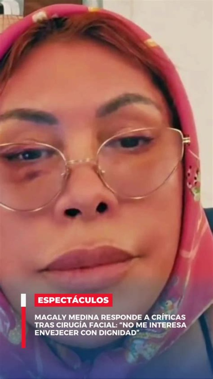 Marlett Medina took to TikTok to show off her surgery journey