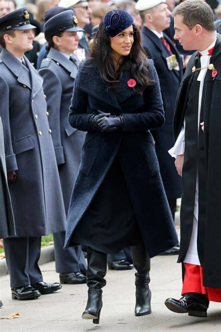 Meghan Markle knee gives a good likeness of John Hurt as the Elephant Man