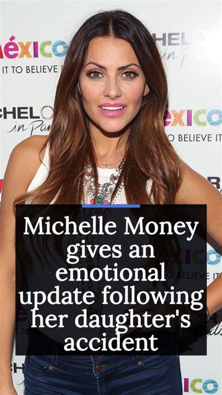  Michelle Money revealed the CT scan of daughter Brielle's skull
