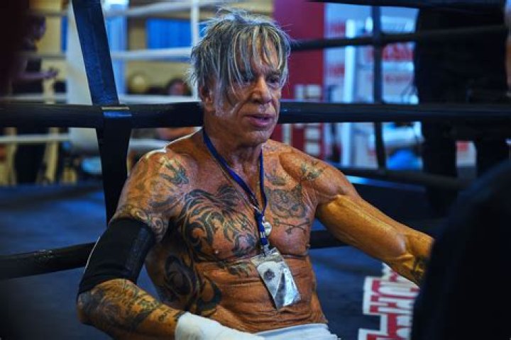 Mickey Rourke said his boxing led to him having his face reconstructed